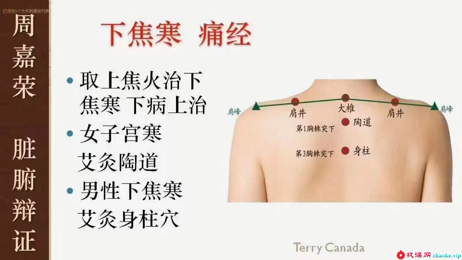 周嘉荣 宗筋疗法