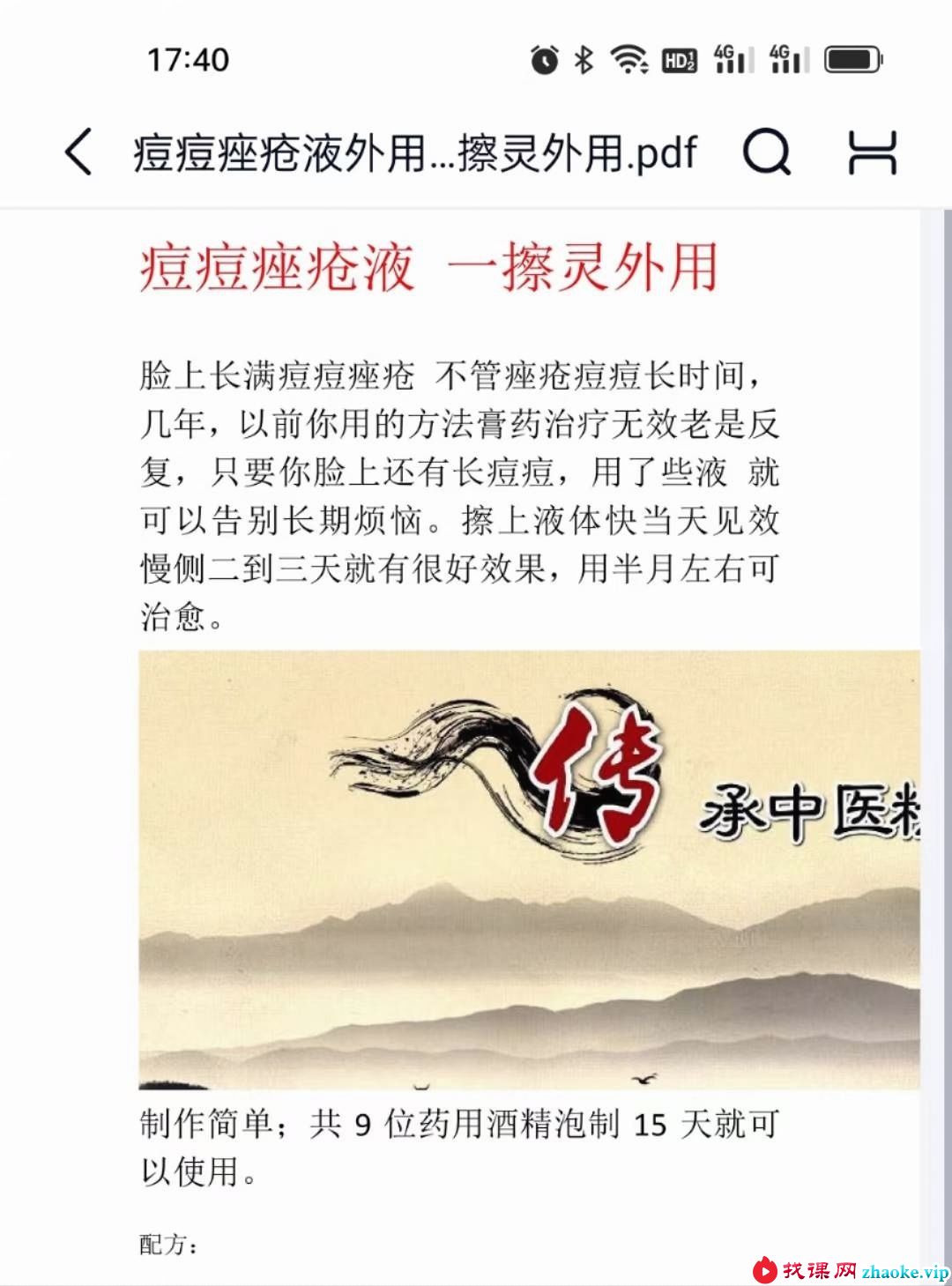 痘痘痤疮液外用 一擦灵外用