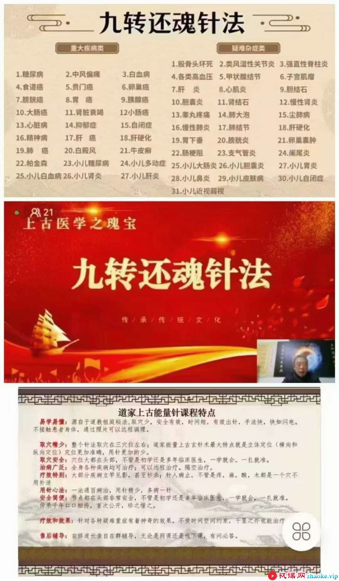 王通福上古医学九转还魂针法1集