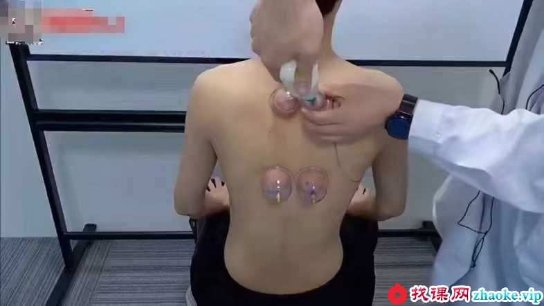 姚梅良 蒙医奇门罐阵5集
